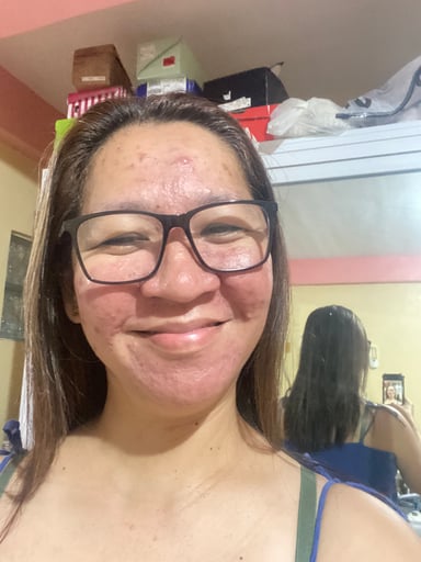 Joemarie Venus, 47