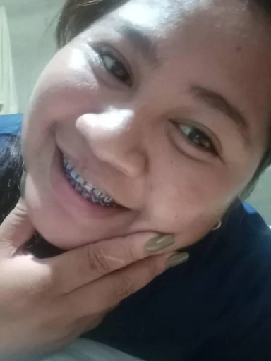 Marfe, 31