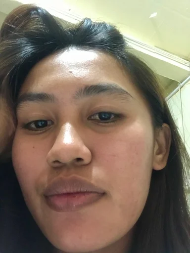 Carie, 25