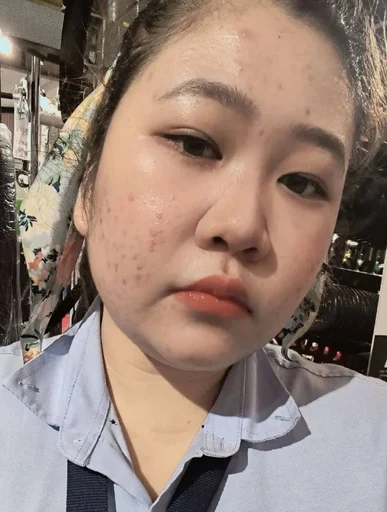 Eisor, 30